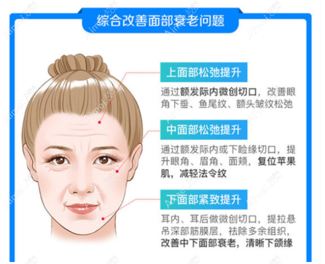 深圳富华医院李俊医生smas面部提升怎么样 深圳富华医院李俊医生smas面部提升怎么样