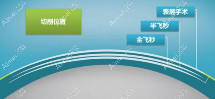 全飞秒真实缺点 全飞秒真实缺点