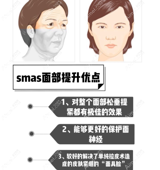 smas面部提升国内出名医生前10名名单 smas面部提升国内出名医生前10名名单