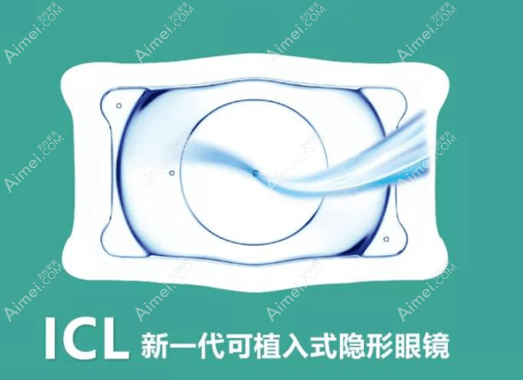 icl晶体移位概率大吗 icl晶体移位概率大吗