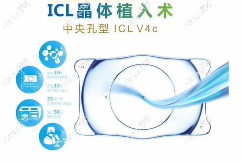 昆明眼科医院做icl晶体植入技术好 昆明眼科医院做icl晶体植入技术好