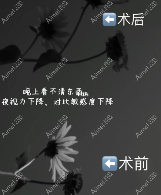 近视眼激光术后出现后遗症看东西模糊 近视眼激光术后出现后遗症看东西模糊