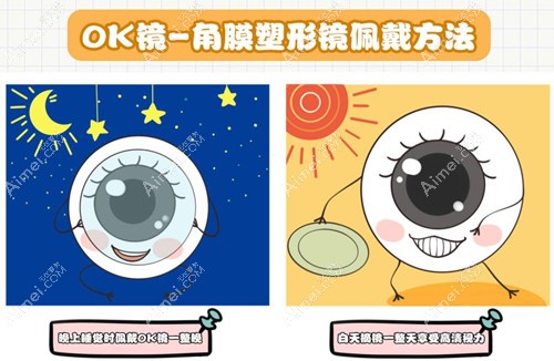 角膜塑形镜佩戴方式 角膜塑形镜佩戴方式