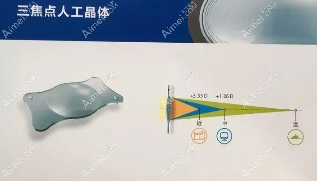 三焦点人工晶体优缺点