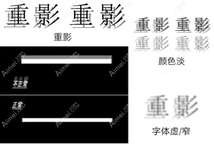 全飞秒手术的弊端