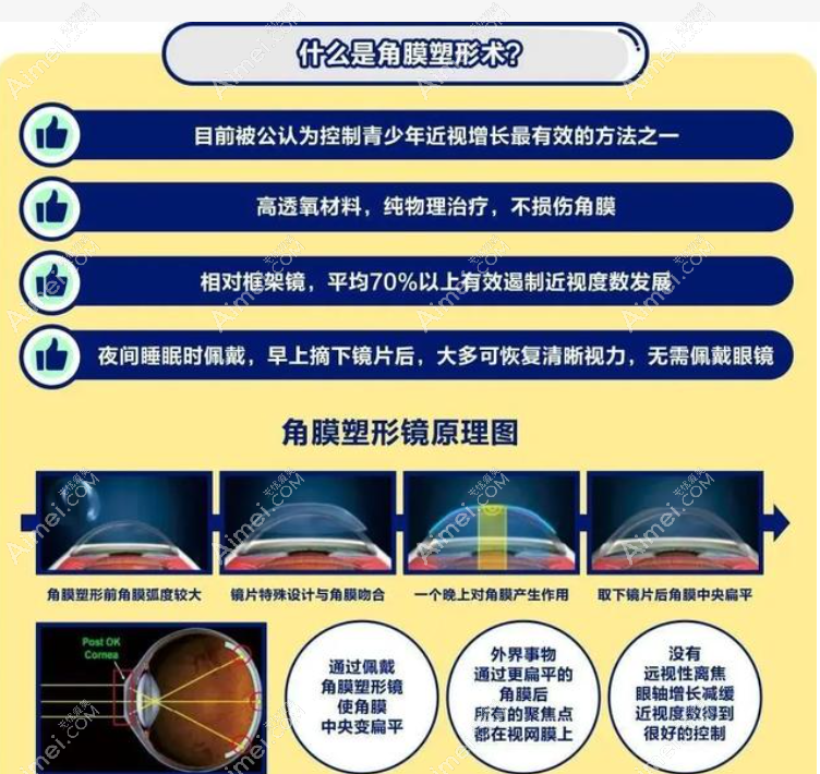 crt角膜塑形镜价格表 crt角膜塑形镜价格表