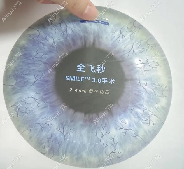 全飞秒手术切口图 全飞秒手术切口图