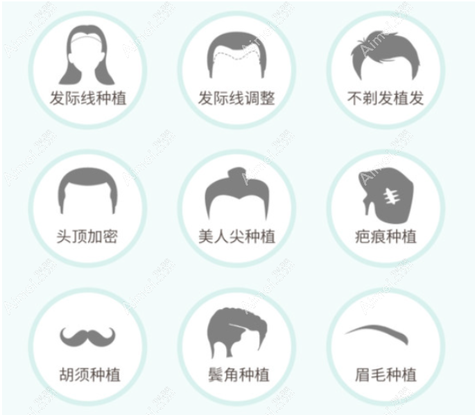 乌鲁木齐丝倍森植发怎么样 乌鲁木齐丝倍森植发怎么样