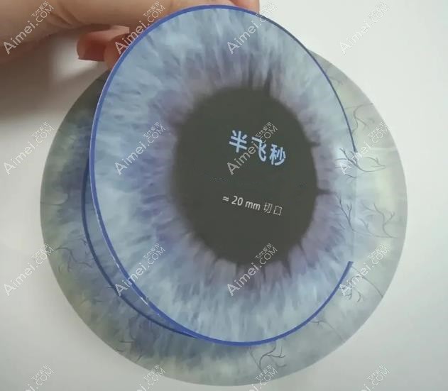 半飞秒手术切口图 半飞秒手术切口图