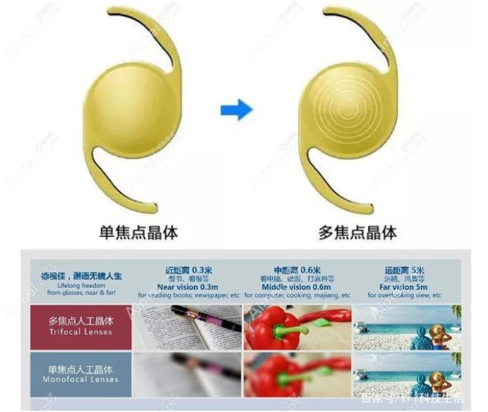 美国博士伦人工晶体怎么样 美国博士伦人工晶体怎么样