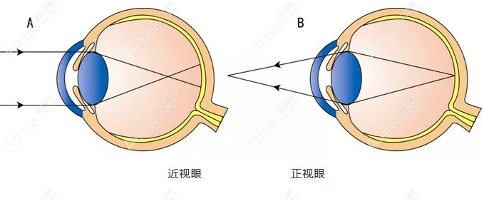 南京近视眼手术价格8800元起 南京近视眼手术价格8800元起
