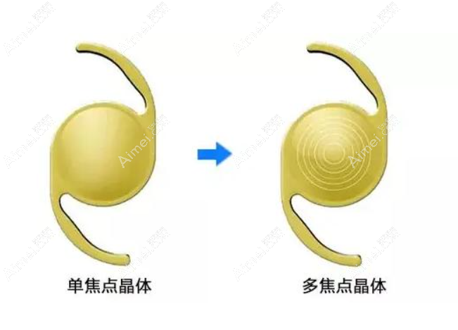 美国强生眼力健人工晶体zma00价格 美国强生眼力健人工晶体zma00价格