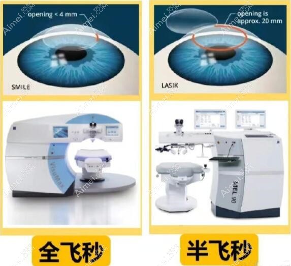 惠州希玛林顺潮眼科做近视手术价格 惠州希玛林顺潮眼科做近视手术价格