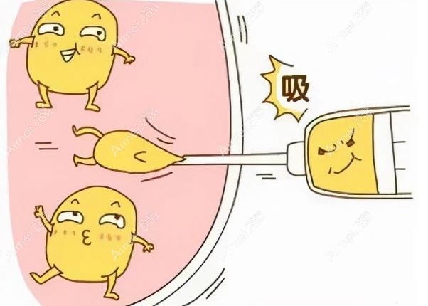 重庆军科吸脂怎么样?赵亚均和王棚医生抽脂靠谱,失败几率小