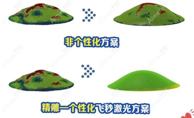 精diao绿飞秒手术原理 精diao绿飞秒手术原理