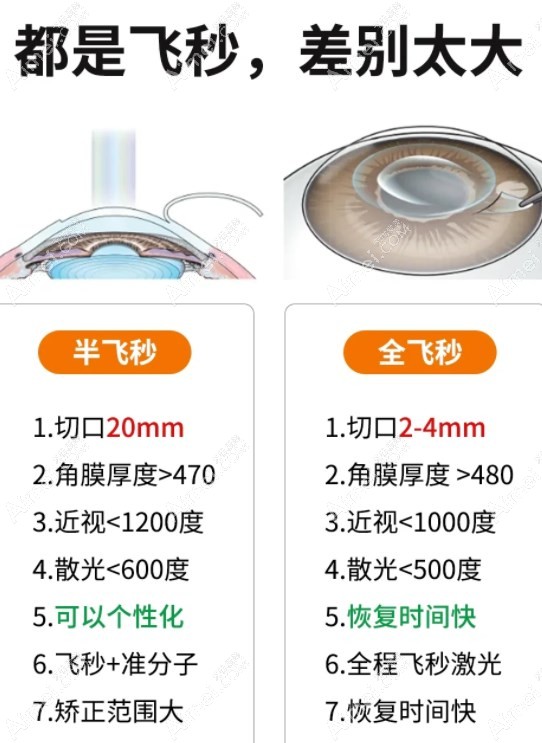 全飞秒和半飞秒区别m.a&imei.com 全飞秒和半飞秒区别m.a&imei.com