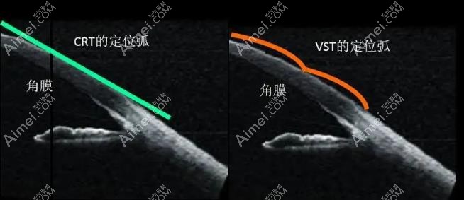 进口ok镜美国crt和日本阿尔法哪个好 进口ok镜美国crt和日本阿尔法哪个好