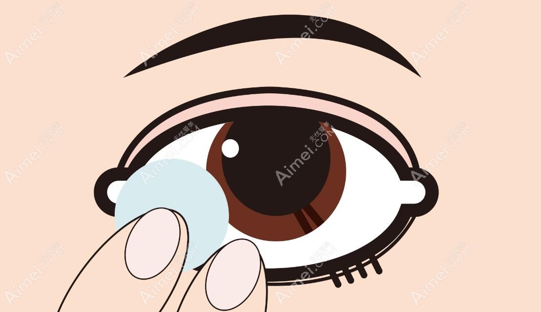 梦戴维角膜塑形镜怎么样 梦戴维角膜塑形镜怎么样