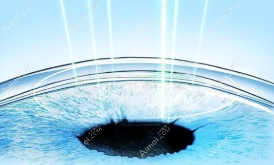 武汉佰视佳眼科激光近视手术价格表:半飞秒1.15w+/全飞秒1.45w+