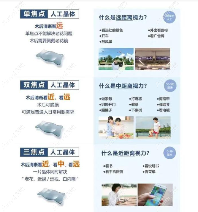 蔡司509m和509mp人工晶体区别 蔡司509m和509mp人工晶体区别