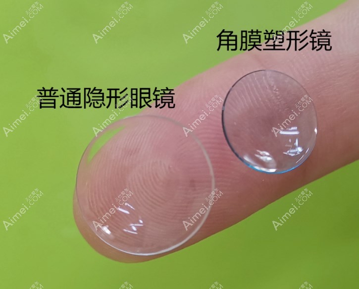 日戴维rgp角膜塑形镜 日戴维rgp角膜塑形镜
