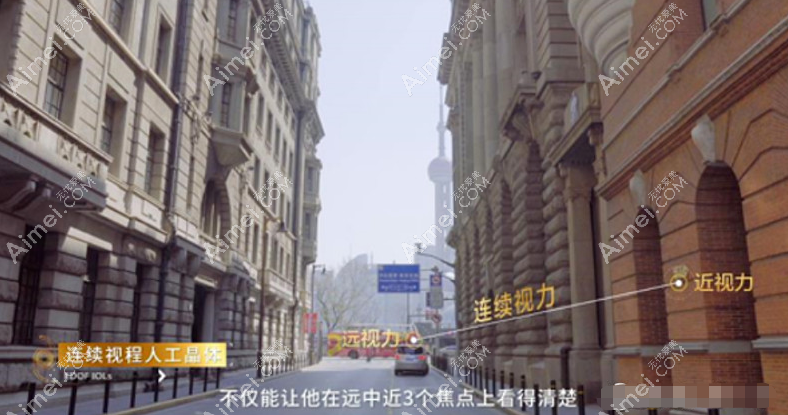 新无极人工晶体视觉质量怎么样 新无极人工晶体视觉质量怎么样