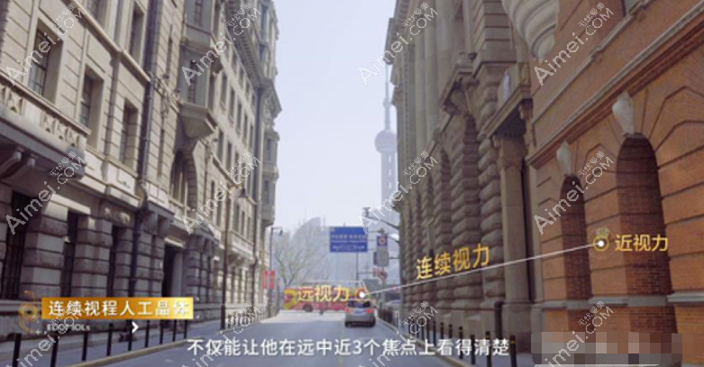 新无极人工晶体术后成像 新无极人工晶体术后成像