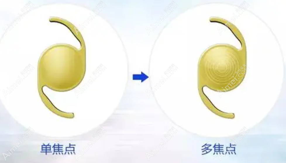 10000多的白内障晶体是中高端晶体水平 10000多的白内障晶体是中高端晶体水平
