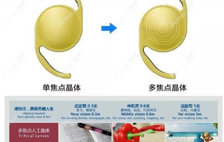白内障晶体3000的好吗 白内障晶体3000的好吗