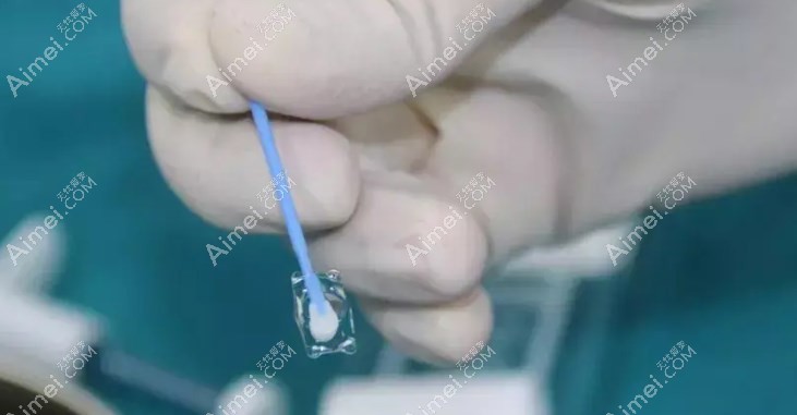 南京icl官网认证医生 南京icl官网认证医生