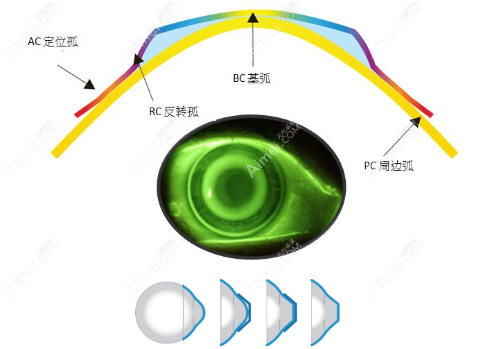 荷兰OK镜 dreamlite怎么设计