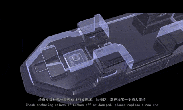 预装式人工晶体植入过程步骤动图