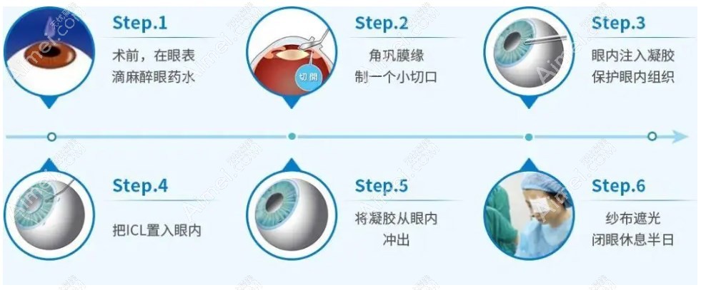 广东省icl官网认证医生查询 广东省icl官网认证医生查询