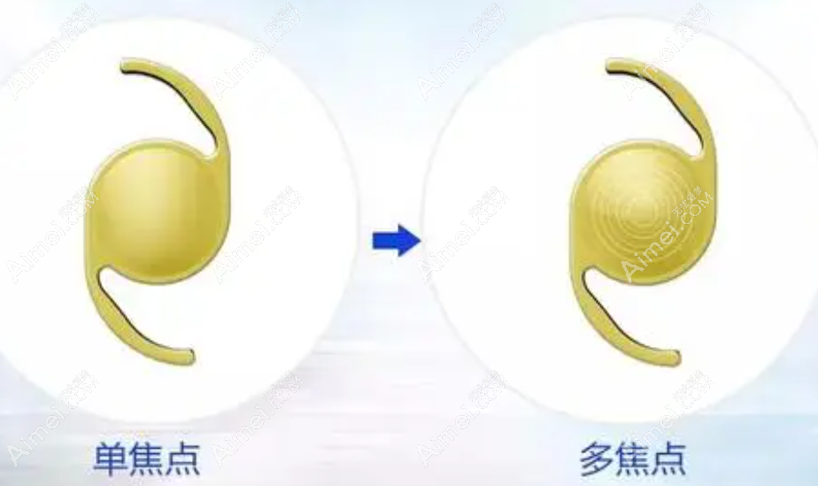 上海老人白内障手术费用和方法 上海老人白内障手术费用和方法