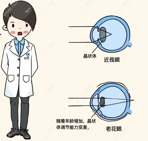 激光近视手术不能矫正老花眼,激光,全飞秒手术主要矫正近视