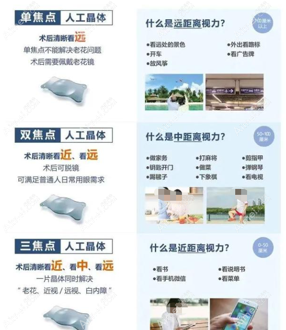 蔡司409m和蔡司409mp区别 蔡司409m和蔡司409mp区别