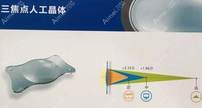 55岁近视600度做多焦点晶体植入手术优缺点