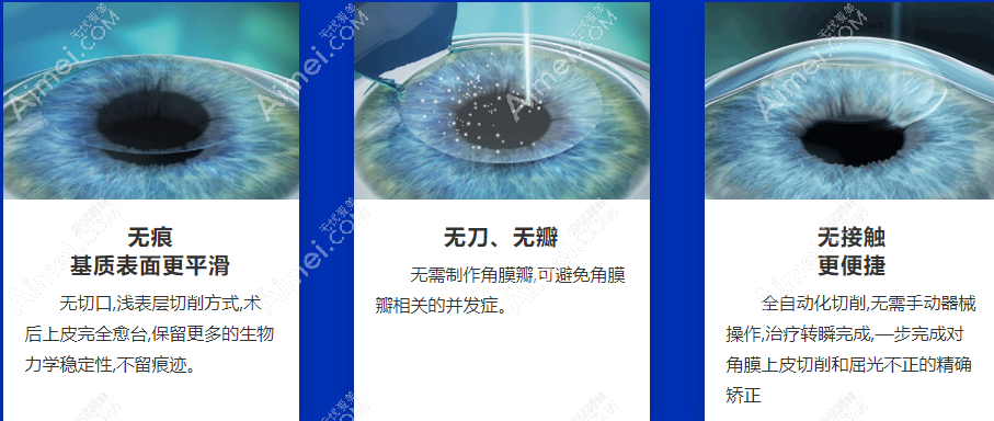 广州视百年眼科全飞秒激光近视手术好 广州视百年眼科全飞秒激光近视手术好