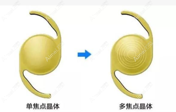 老年人换晶体不建议使用双焦点晶体和三焦点人工晶体 老年人换晶体不建议使用双焦点晶体和三焦点人工晶体