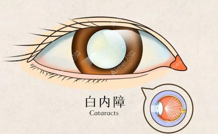 临沂华厦眼科医院是正规医院 临沂华厦眼科医院是正规医院