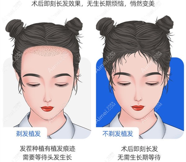 碧莲盛不剃发长发种植 碧莲盛不剃发长发种植