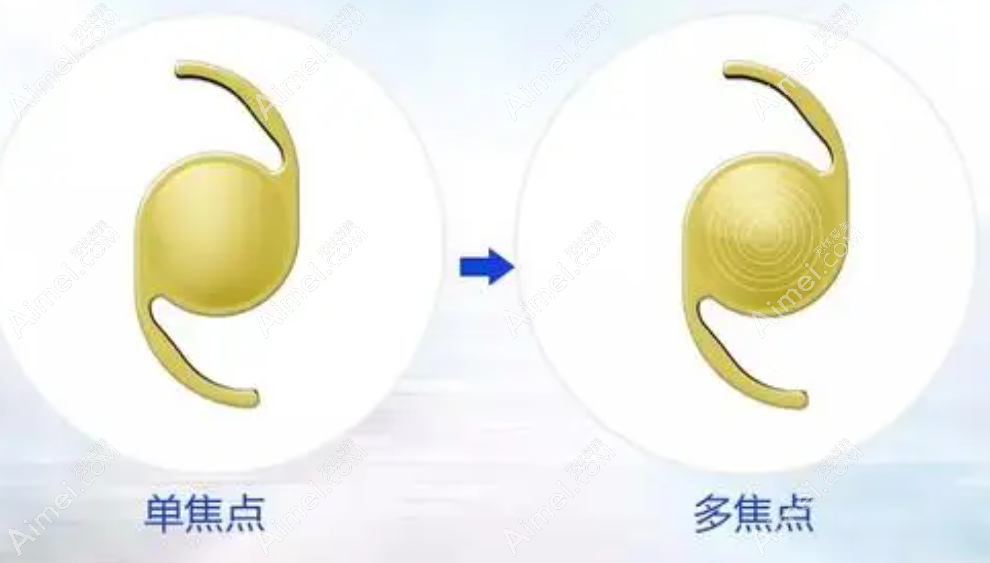 年轻人白内障晶体换贵点的还是便宜点的好 年轻人白内障晶体换贵点的还是便宜点的好