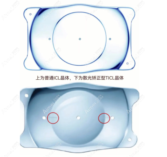 高度近视加散光晶体植入费用dlren.com 高度近视加散光晶体植入费用dlren.com