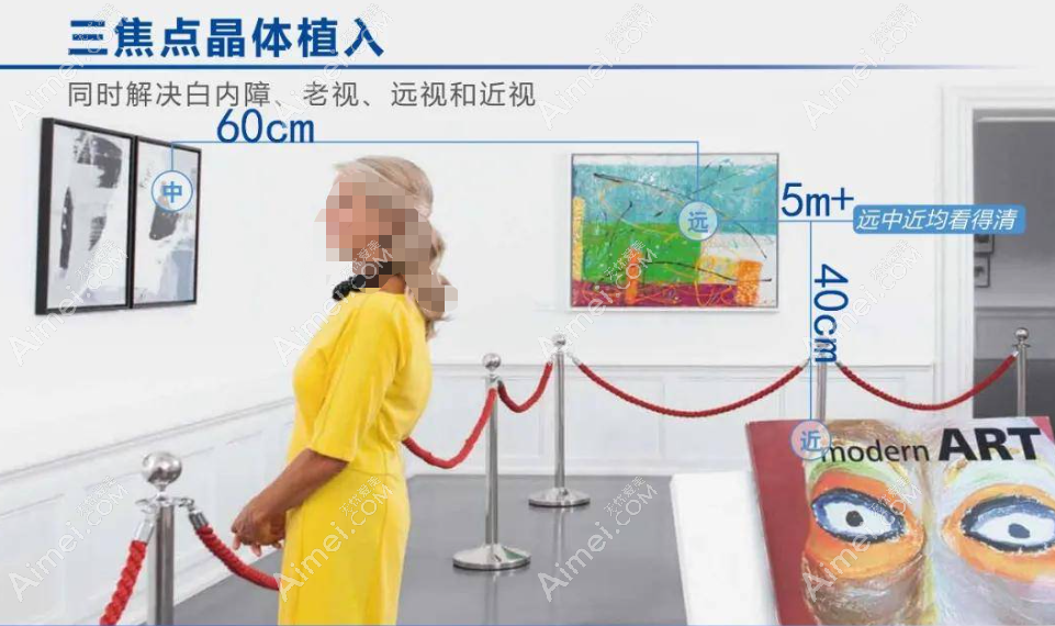 全视觉三焦点人工晶体怎么样 全视觉三焦点人工晶体怎么样