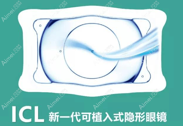 北京爱尔眼科icl手术流程 北京爱尔眼科icl手术流程