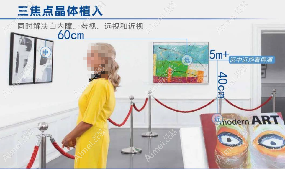 三焦点人工晶体远中近都看得清 三焦点人工晶体远中近都看得清