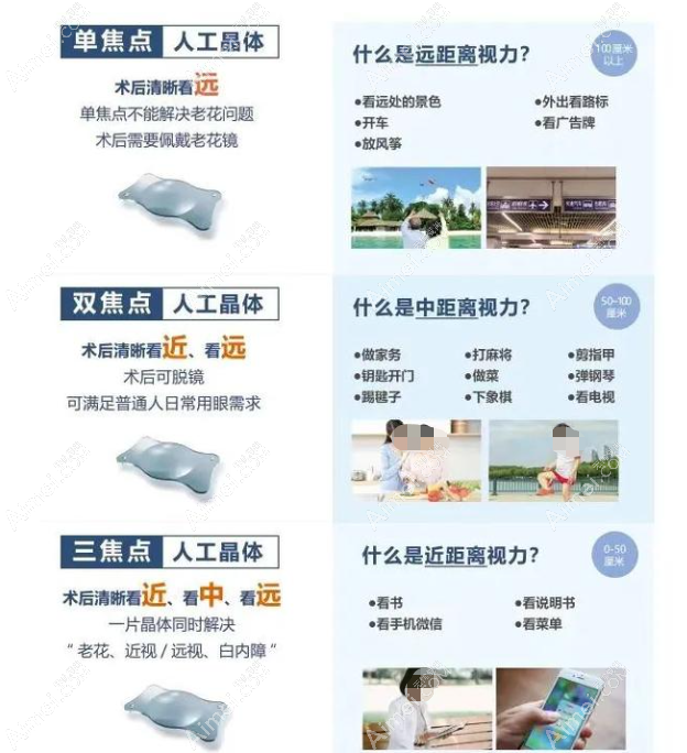 三焦点人工晶体植入后真实感受 三焦点人工晶体植入后真实感受