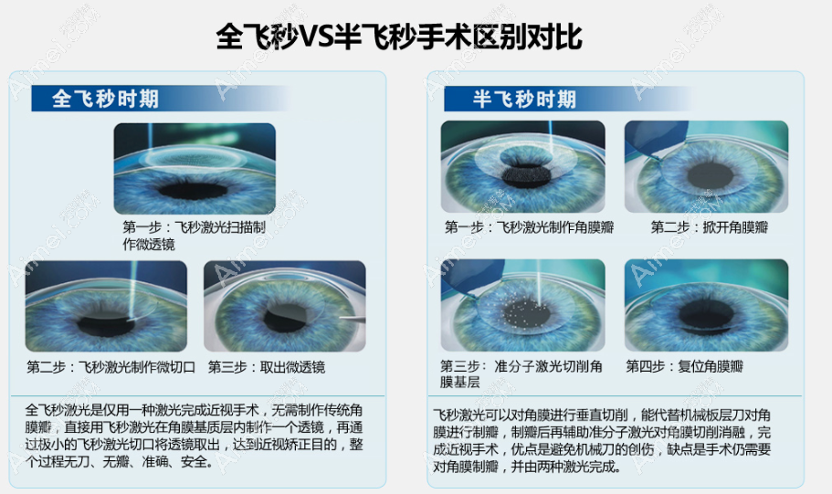 全飞秒和半飞秒区别图片 全飞秒和半飞秒区别图片