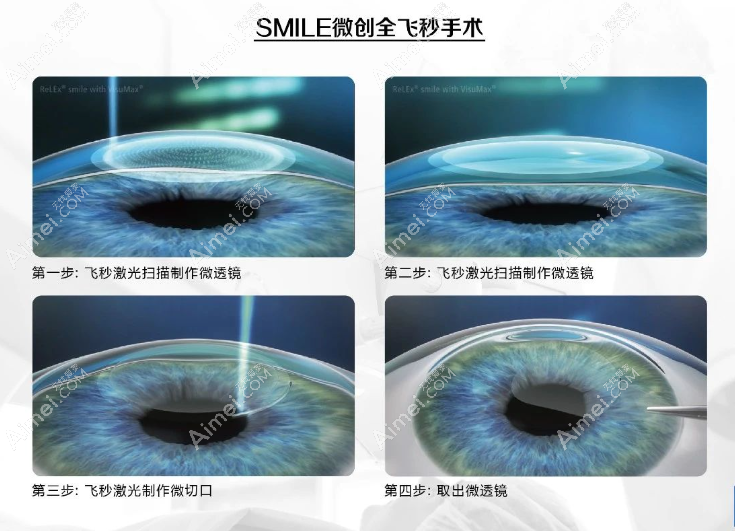 深圳罗湖区宝山区飞秒激光价格一览表 深圳罗湖区宝山区飞秒激光价格一览表