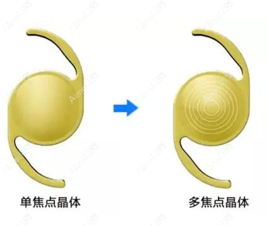 美国眼力健zmboo多焦人工晶体价格dlren.com 美国眼力健zmboo多焦人工晶体价格dlren.com